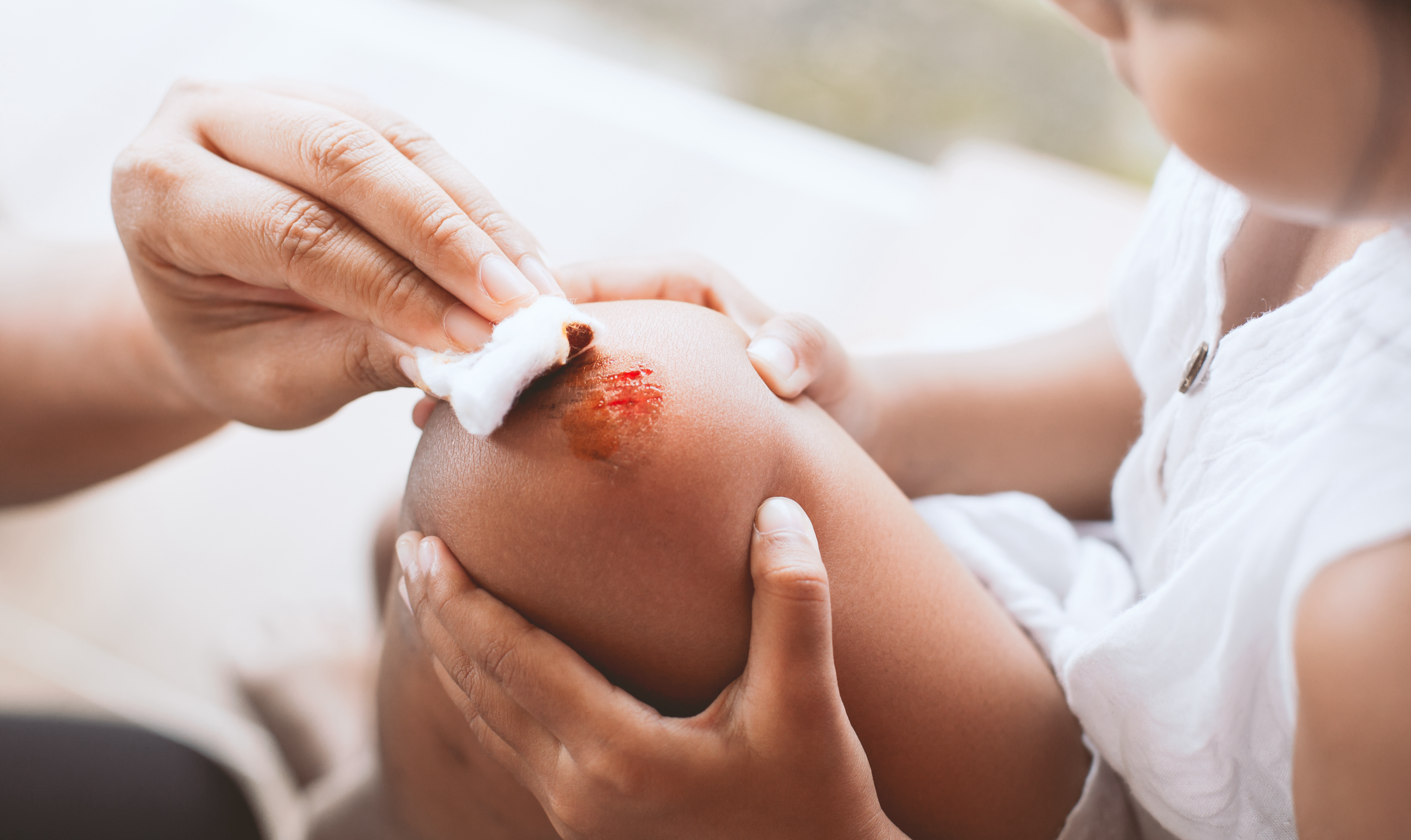 Parent helping a child with first aid on a scraped knee